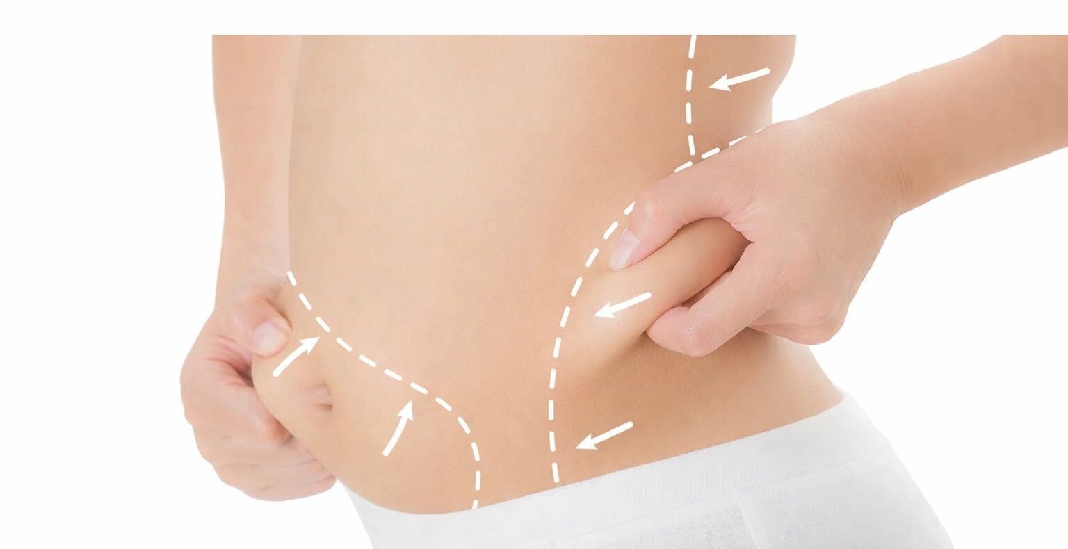 HYARON PREFILLED INJ